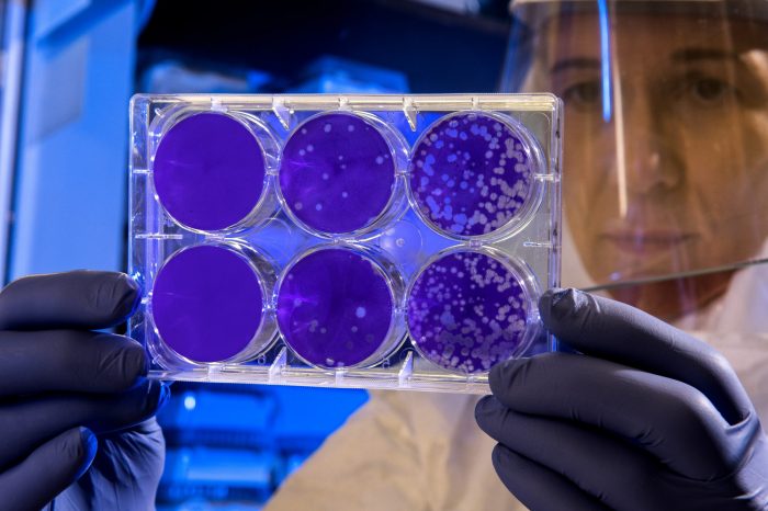 A scientist studying bacteria 